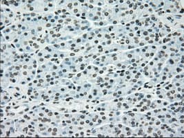 Monoclonal Mouse anti-Human BRAF / B-Raf Antibody (clone OTI4G6, IHC, WB)