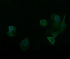 RARRES1 Antibody (clone OTI1A6)