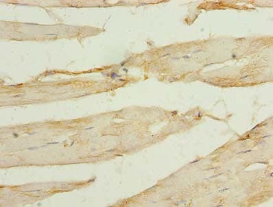 SORBS3 / Vinexin Antibody