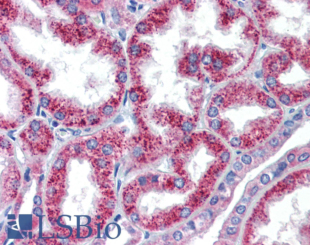 HOXA5 Antibody (C-Terminus)