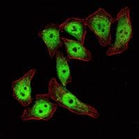 KLF4 Antibody (clone 1000000)