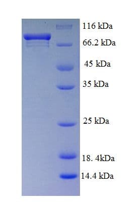 Mouse MYC / c-Myc Protein (Recombinant GST, N-terminus)