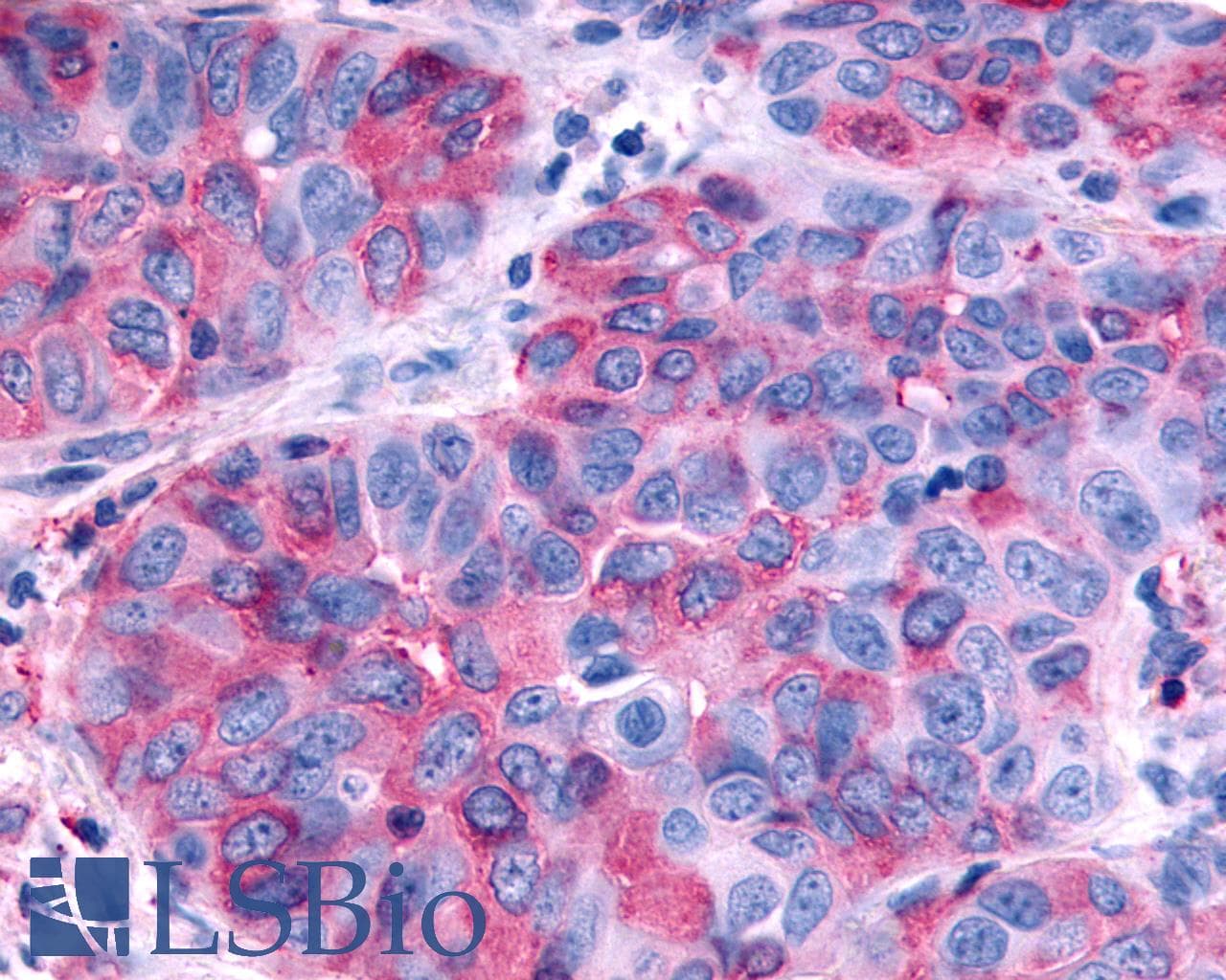PathPlus™ Polyclonal Rabbit anti-Human RXFP2 / LGR8 Antibody (Extracellular Domain, IHC)