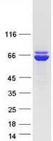 Human P5CDH / ALDH4A1 Protein (Recombinant Myc-DDK (Flag))