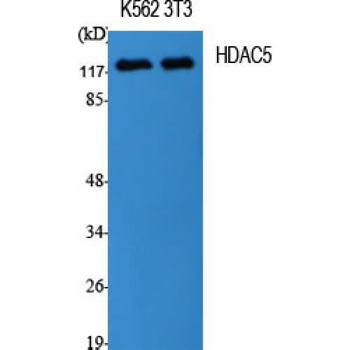 HDAC5 Antibody (440-520 aa)