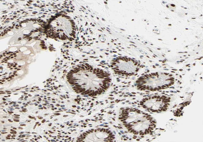 Polyclonal Rabbit anti-Human RCBTB1 Antibody (IHC, IF, WB)