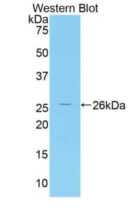 IRAK3 / IRAKM / IRAK-M Antibody (aa201-410, FITC)