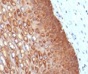 KRT14 / CK14 / Cytokeratin 14 Antibody (clone CTKN14-1, Ready-to-Use)