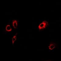 TMOD4 Antibody
