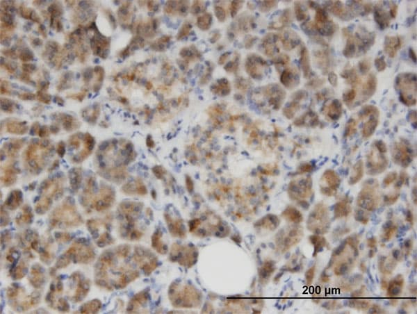 GLYAT Antibody (clone 1A10)