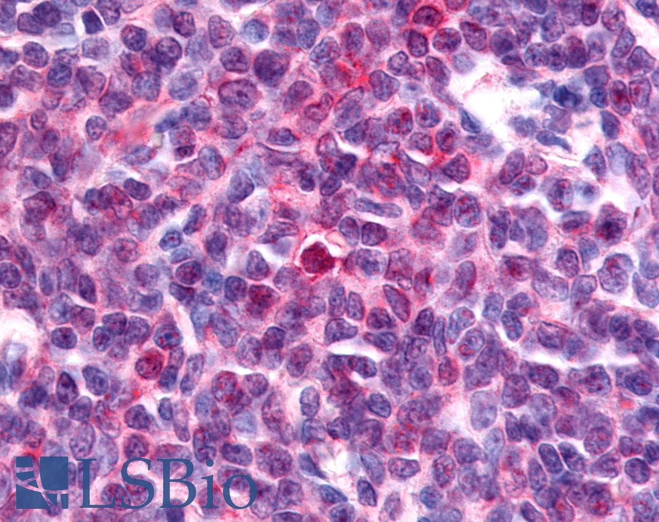 PathPlus™ Nor-1 / NR4A3 Antibody (Modulating Domain)
