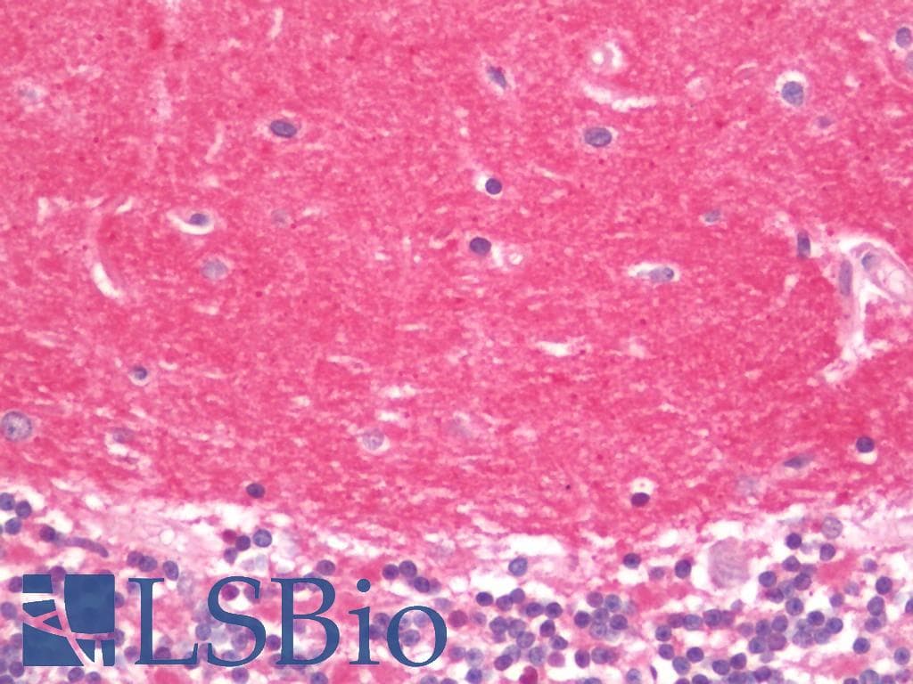 MCAM / CD146 Antibody (HRP)