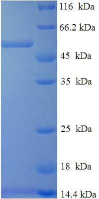 Human DHRS7 Protein (Recombinant His-SUMO)