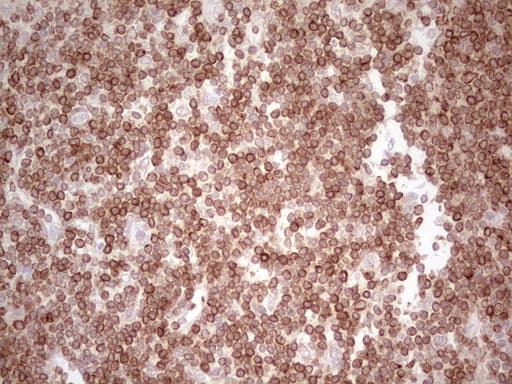 BCL2 / Bcl-2 Antibody (clone OTI10C7)