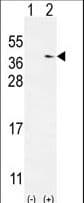 NME9 / TXNDC6 Antibody (aa111-139)