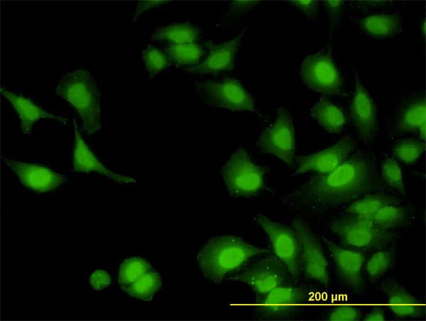 IHC-plus™ Monoclonal Mouse anti-Human IRAK1 / IRAK Antibody (clone 3A9, IHC, IF, WB)