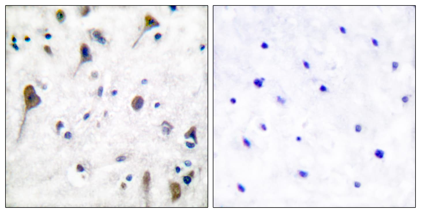 Polyclonal Rabbit anti-Human PTK2B / PYK2 Antibody (phospho-Tyr580, IHC, WB)