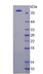 Human GRIN2B / NMDAR2B / NR2B Protein (Recombinant His-GST, N-terminus)