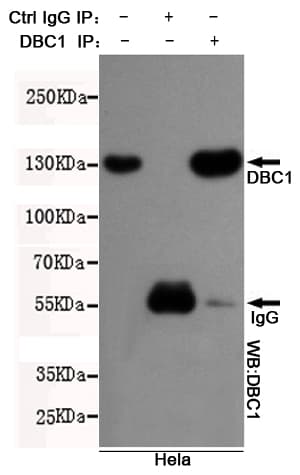 CCAR2 / KIAA1967 Antibody