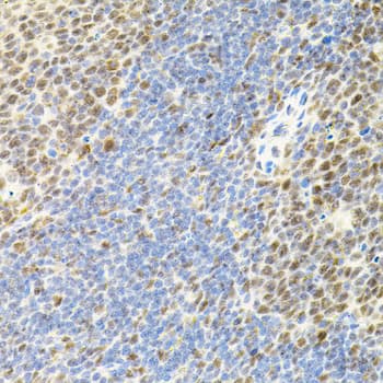 DAP-5 / EIF4G2 Antibody