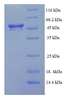 Human ALDH5A1 Protein (Recombinant 6His, N-terminus)
