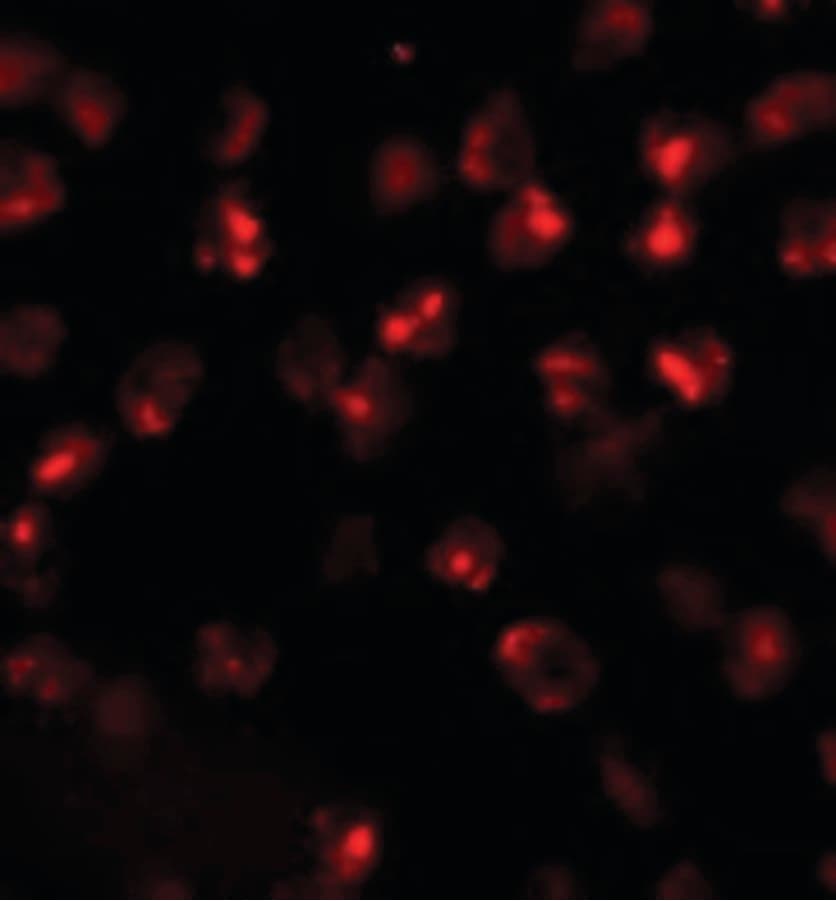 Polyclonal Rabbit anti-Human KIAA0703 / SPCA2 Antibody (IF, WB)