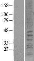 CNR2 / CB2 Protein (Over-Expression Lysate Myc-DDK (Flag))