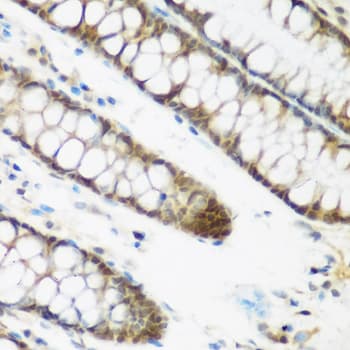 NCBP2 / CBP20 Antibody