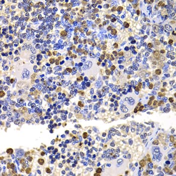 MMS2 / UBE2V2 Antibody