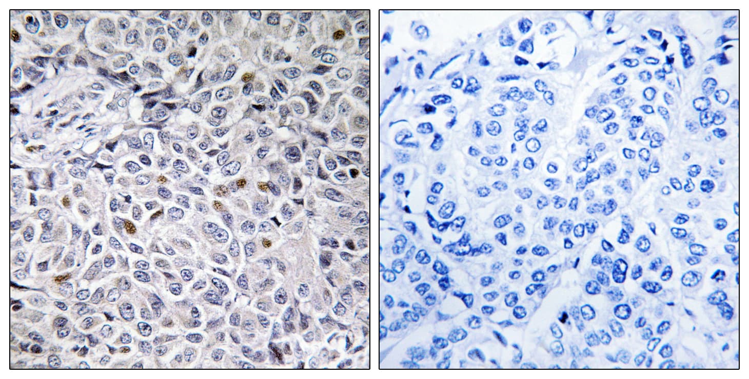 Polyclonal Rabbit anti-Human ZAP70 Antibody (aa281-330, IHC)