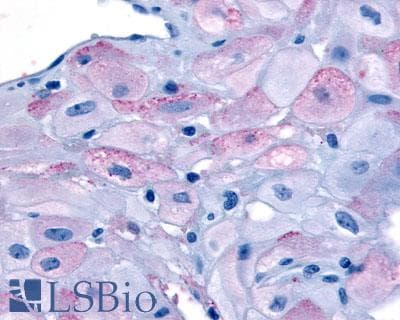 PathPlus™ Polyclonal Rabbit anti-Human OXTR / Oxytocin Receptor Antibody (Cytoplasmic Domain, IHC)