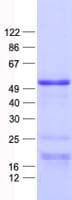 Human SOX7 Protein (Recombinant His, N-Terminal)