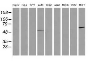 CCT8L2 Antibody (clone OTI4A4)