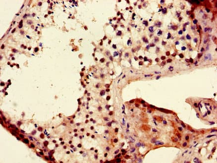 LIN28B Antibody