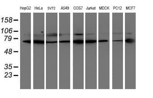LIMK1 / LIMK Antibody (clone OTI6B4)