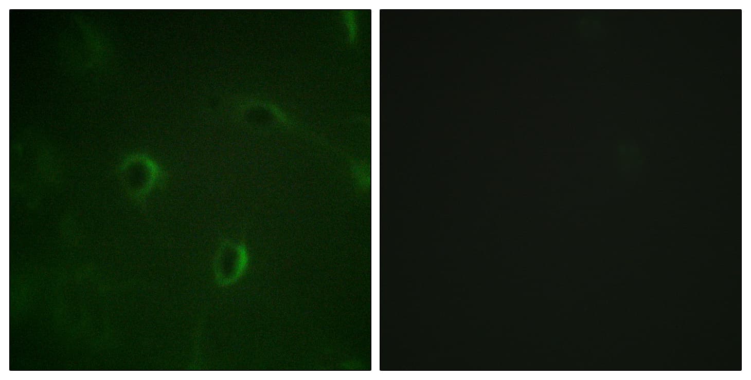INSR / Insulin Receptor Antibody (aa1326-1375)