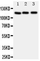 PPP1R12A / MYPT1 Antibody (aa1-17)