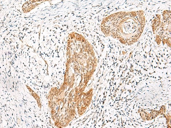 HNF1A / HNF1 Antibody