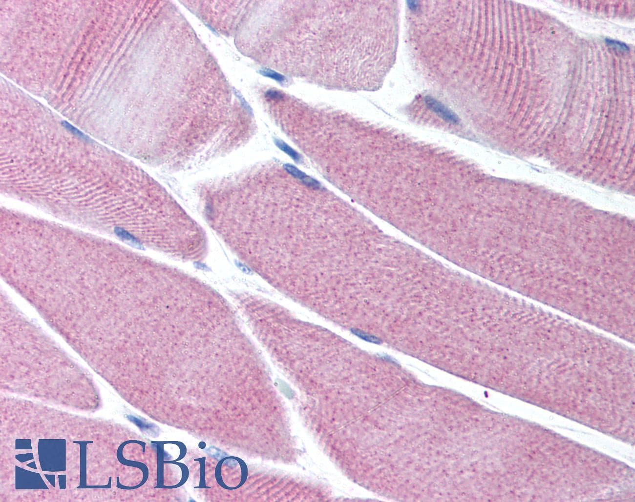 IHC-plus™ PAK2 Antibody