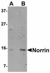 NDP Antibody