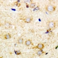PUM1 Antibody