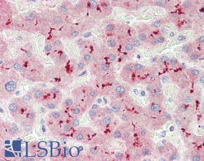 IHC-plus™ Polyclonal Rabbit anti-Human IRS2 / IRS-2 Antibody (aa1100-1150, IHC, WB)