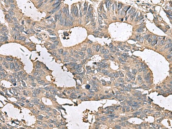 MRPL42 / MRPS32 Antibody