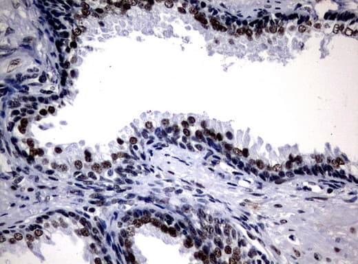 Monoclonal Mouse anti-Human NBN / Nibrin Antibody (clone UMAB99, Carrier-free, aa461-754, IHC, IF, WB)