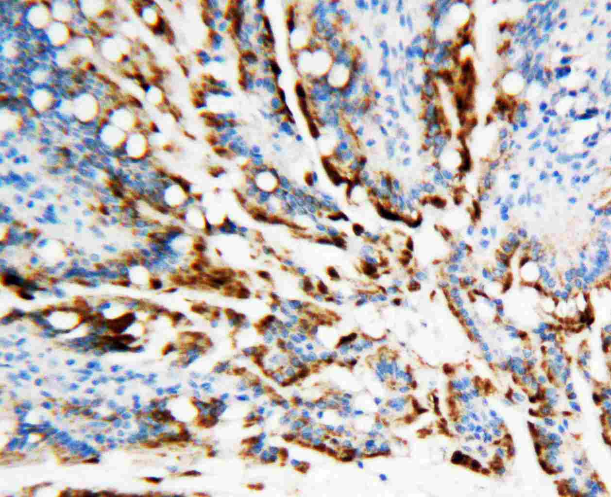 APEX1 / APE1 Antibody (aa177-191)