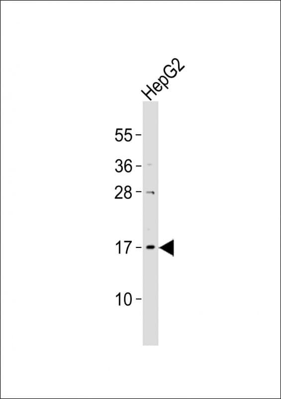 Polyclonal Rabbit anti-Human UBE2N / UBC13 Antibody (aa41-74, WB)