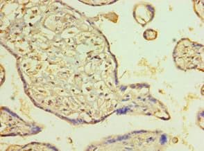 Polyclonal Rabbit anti-Human PDLIM1 Antibody (aa1-329, IHC, WB)