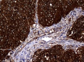 NME1 / NM23 Antibody (clone OTI4G3, Carrier-free)