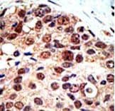 PRMT3 Antibody (aa460-491)