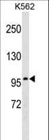 ITGB2 / CD18 Antibody